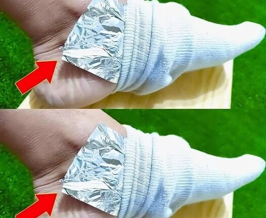 Put Aluminum Foil on Your Feet and Say Goodbye to Aches and Pains: The Surprising Hack