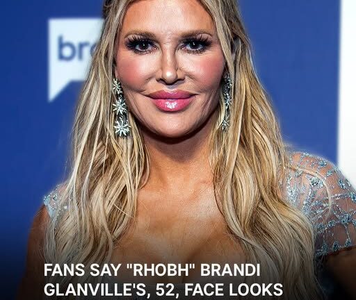 Users Suspect Bravo Star Brandi Glanville Has Health Issues with Her Face Due to ‘Removed Fillers’ – Photo