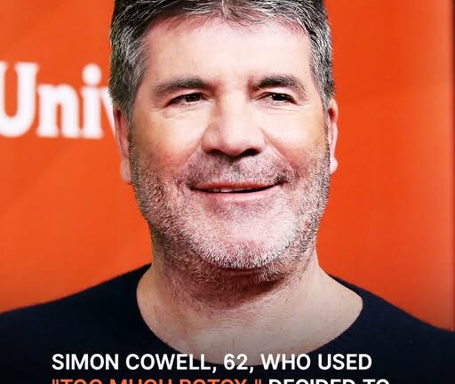 Simon Cowell Removed His Facial Fillers After His Son Had ‘Hysterics’ — Before & After Pics